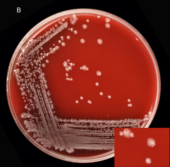 Bacteria growing on a culture plate