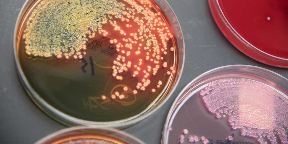 Microbiology Culture Plates used to isolate Stool Pathogens.
