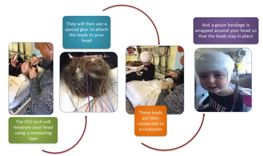 EEG