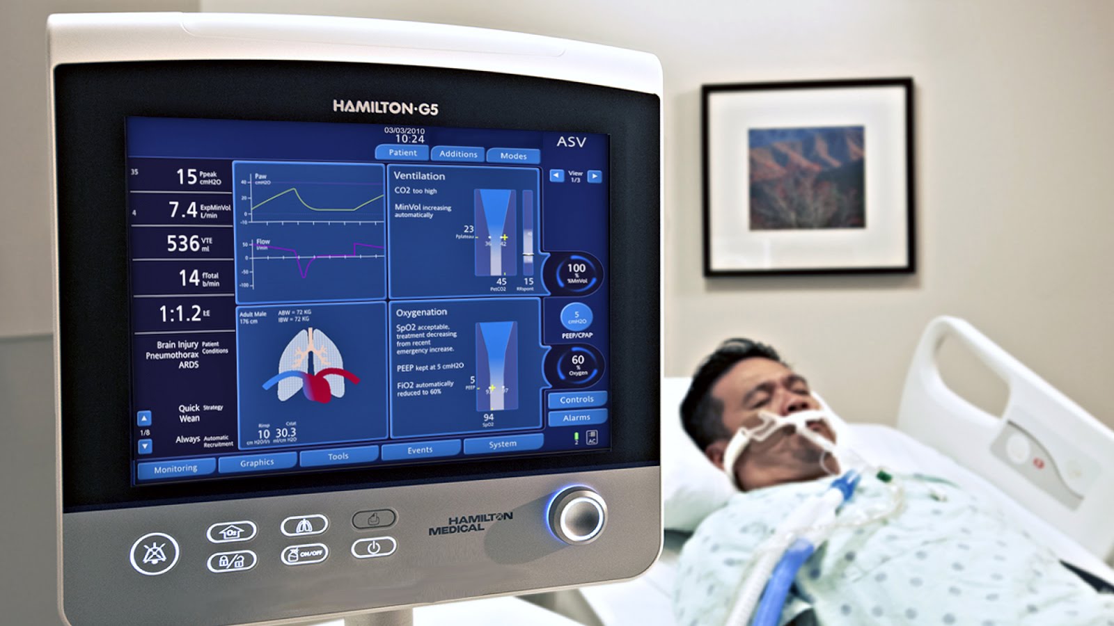 Mechanical Ventilator Lhsc