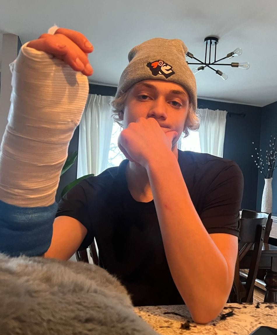 Tyler showing off his bandaged wrist.
