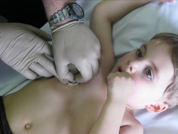 Stabilize port by securely holding down base (disc) of Safe Step Huber Needle with index and middle fingers. Firmly pull the textured handle up until click is felt of heard.
