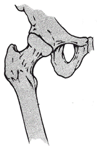 A diagram of the structure of a hip joint
