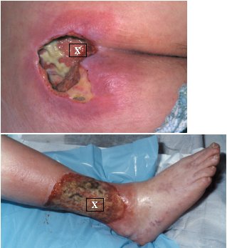 How the swab should be rotated inside the wound