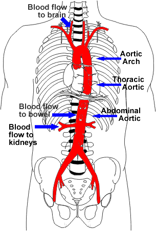 Aorta