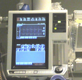 ventilator