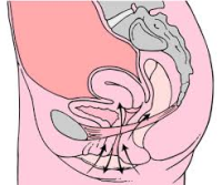 Pelvic Floor Muscle Exercises