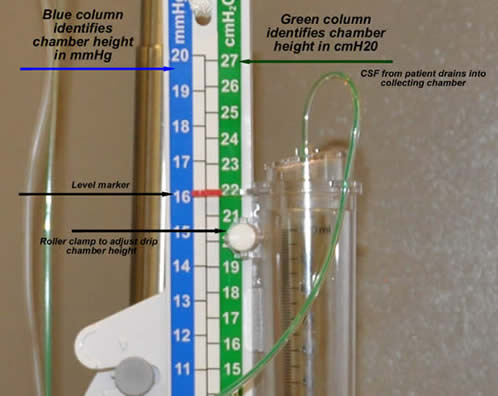 Codman Drain Top