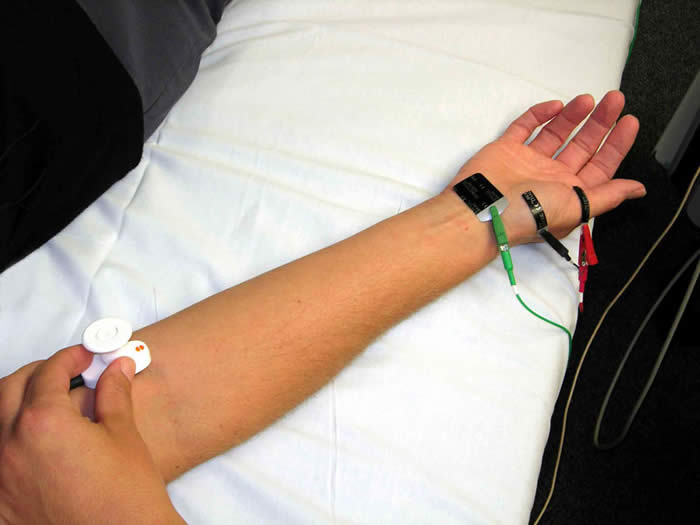 pain after nerve conduction test pain after nerve conduction test