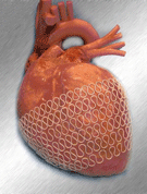 Heart Net