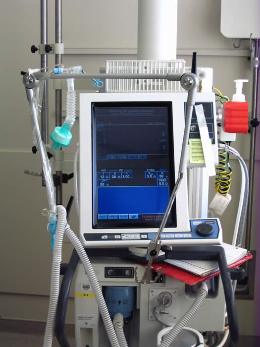 Mechanical Ventilator