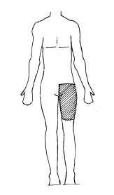 Diagram of pre-hip surgery washing area