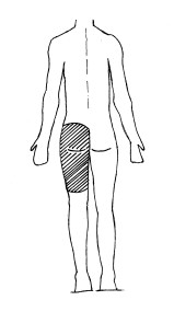 ​ Diagram of pre-hip surgery washing area