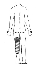 Diagram of pre-knee surgery washing area