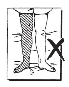 diagram of how to stand after surgery - do not twist leg inward or outward too far