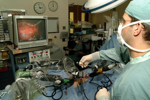 In the foreground you can see the patient and the three robotic arms working through three small incisions in the abdomen