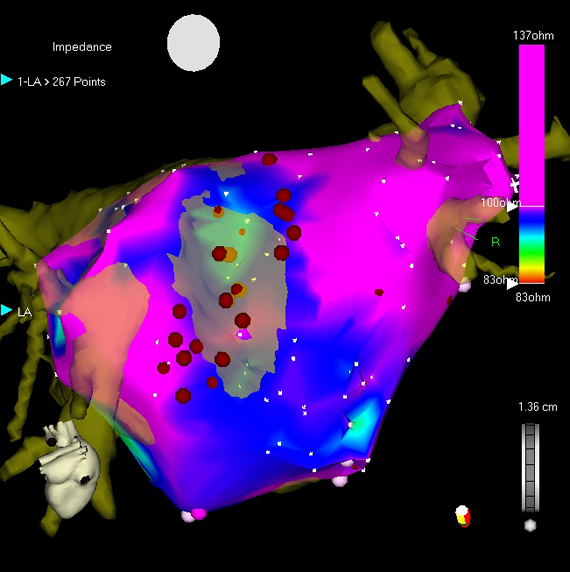 visually place the catheter tip