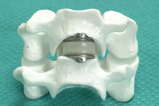 model of the artificial cervical disc 