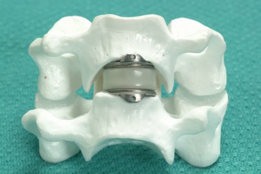 model of the artificial cervical disc
