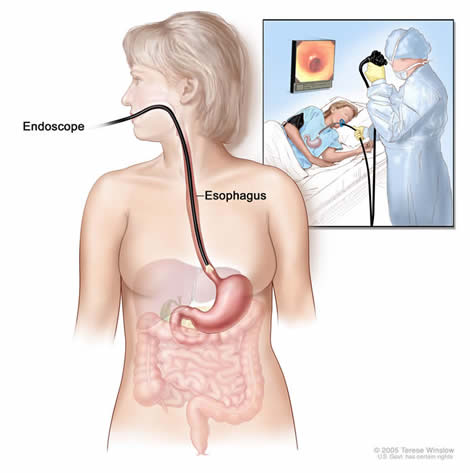 Endoscopy