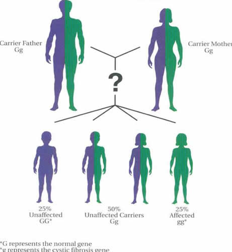 Inherited Cystic Fibrosis diagram