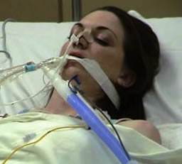 Patient in the ICU