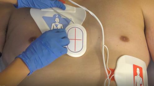 CPR Sensor and Right Chest Pad