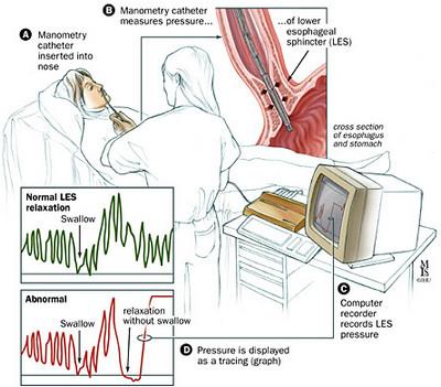 Manometry