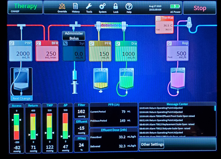 Prismax Display