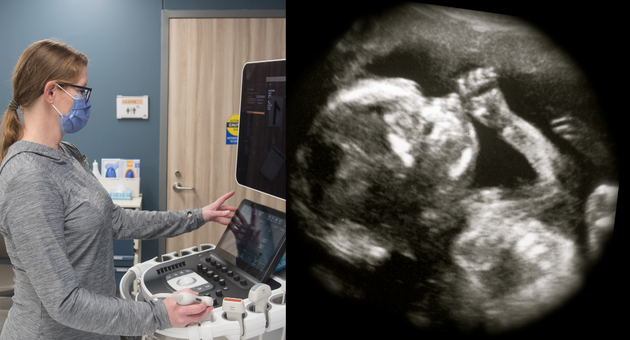 Tracey Fratepietro with an ultrasound machine; an ultrasound image of a fetus