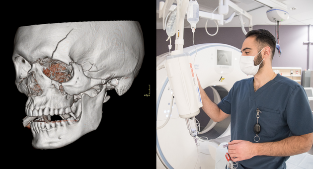 Jason Lazar with a CT machine; a 3D image of a skull fracture