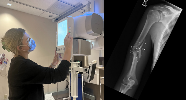 Karly Brown and an x-ray machine; X-Ray of the upper arm (humerus) with gun shot shrapnel