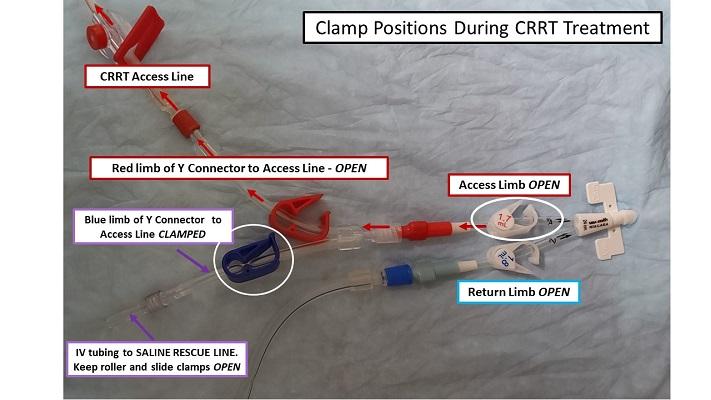 CRRT Rescue Line 