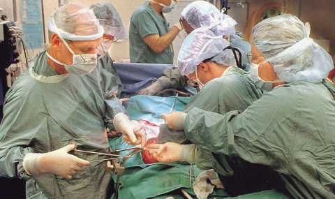 r. Bill Wall (left) works to implant a liver in a patient in the 1990s. Later Dr. David Grant took over to implant the small bowel. Photo credit: London Free Press, a division of Postmedia Network Inc. 