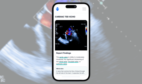 Sample screen of the PocketHealth app