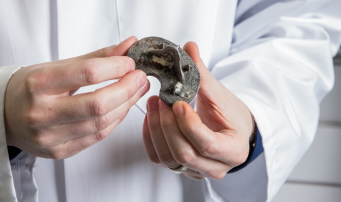 LHSCRI scientist Dr. Matthew Teeter holds a cementless tibial baseplate from a total knee replacement.