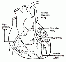 midcab invasive minimally coronary artery