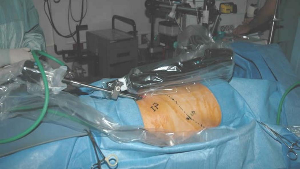 Surgery Slide