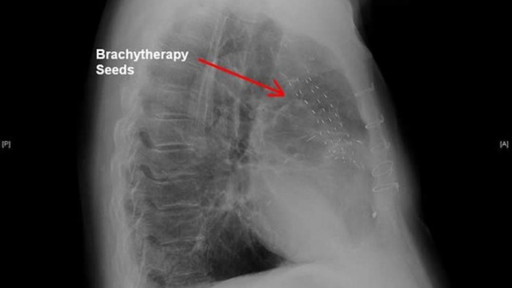 Surgery Slide
