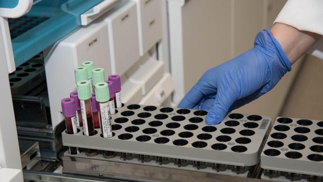 Pilot agreement increases access to lab testing for paediatric oncology patients Thumbnail