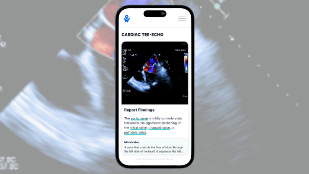 Sample screen of the PocketHealth app